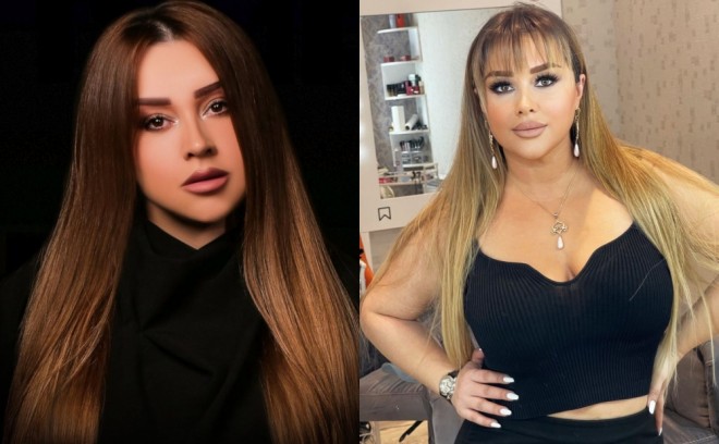 Xatirə saç düzümünü dəyişib - foto