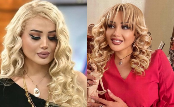 Xalq artisti görünüşündə dəyişiklik etdi - foto