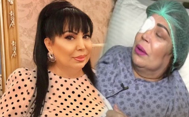 Əməkdar artist gözündən əməliyyat olunub