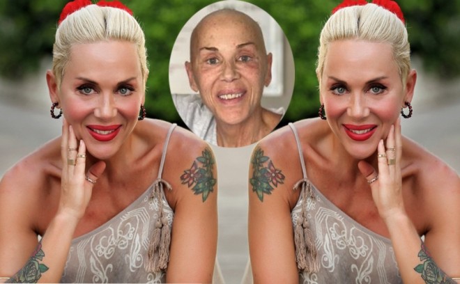 Aktrisa ağciyər xərçəngi aşkarlanıb - foto