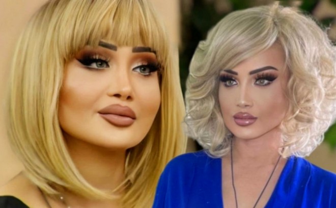 Məleykə plastik əməliyyat etdirir

