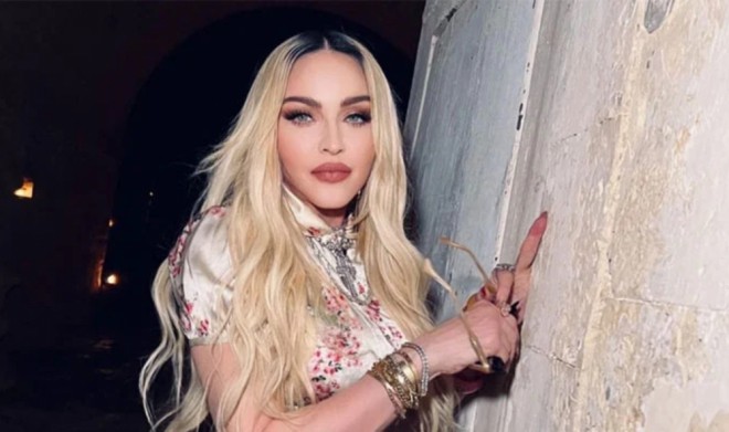 Madonna estetik əməliyyatlarına ildə 150 min dollar xərcləyir