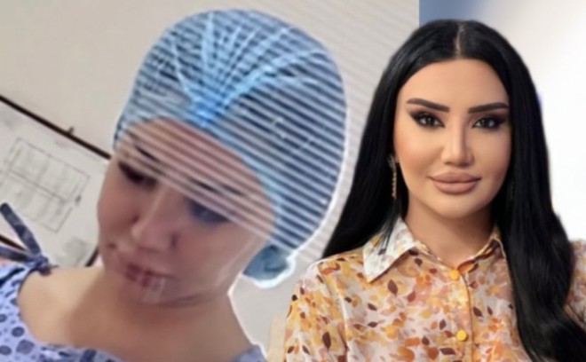 Əməkdar artist estetik əməliyyat etdirib