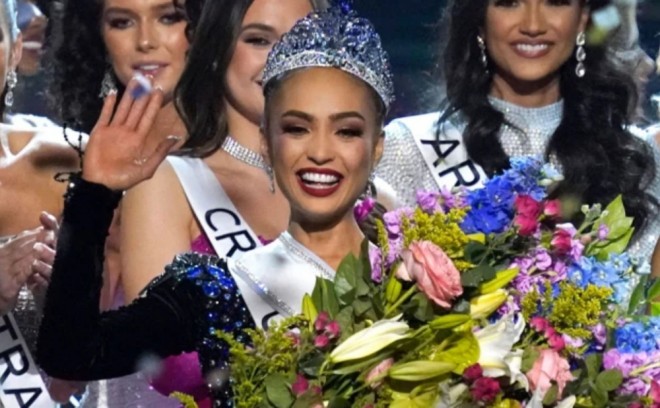 "Kainat gözəli" bəlli olub - foto