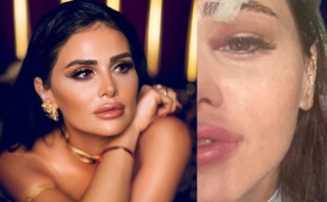 "Yaralandım... Allah qorudu..."