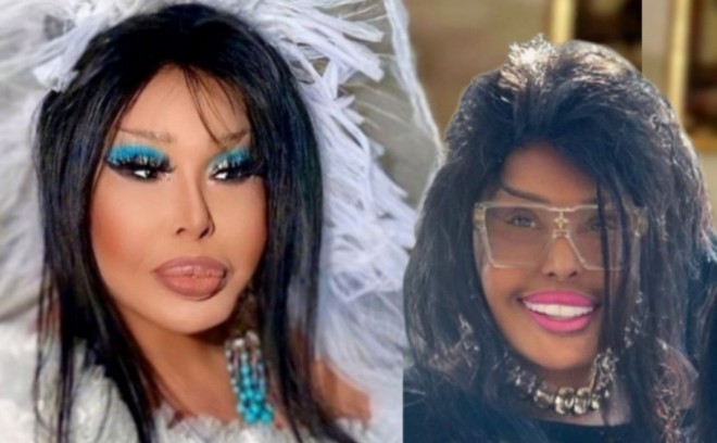 Bülənt Ərsoy yeni imici ilə diqqət çəkib - foto