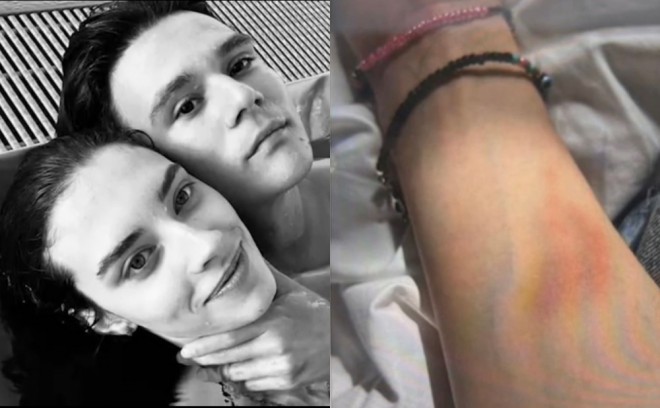 Model keçmiş sevgilisi tərəfindən təhdid edilib - foto