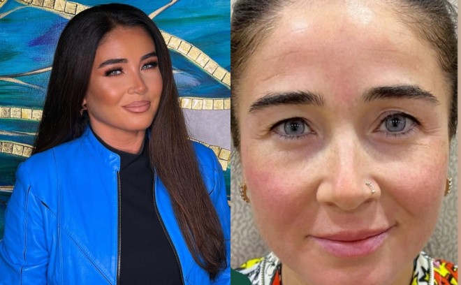 Elnarənin makiyajsız halı - foto