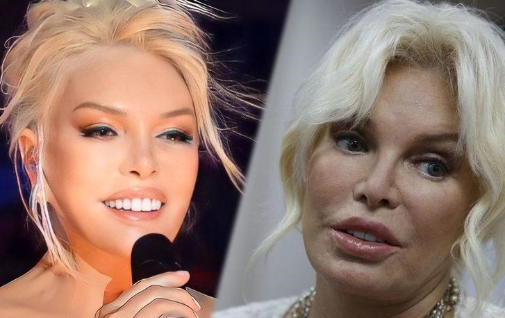 Estetik əməliyyat etdirdi