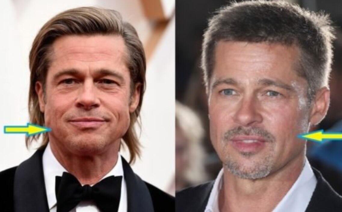 Aktyor plastik əməliyyat etdirib