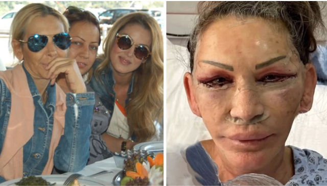 Ana qızından cavan görünür - FOTO