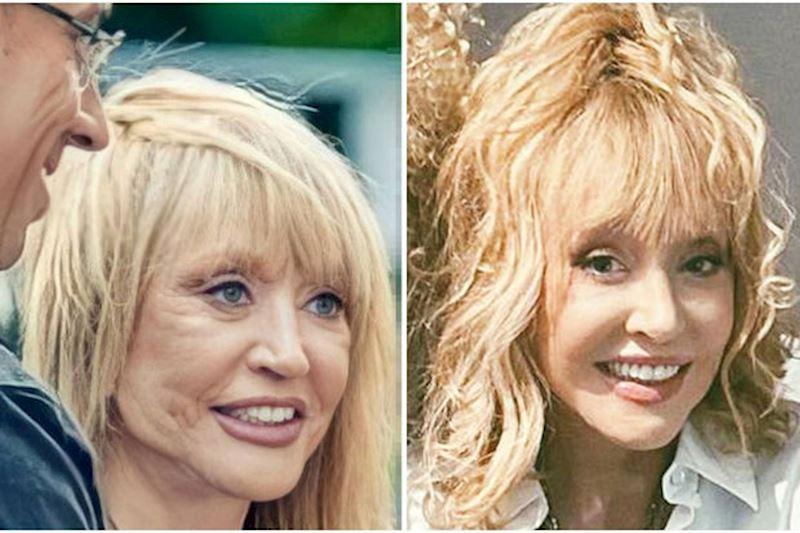 Alla üzünü 3 dəfə dartdırıb