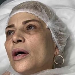 Əməkdar artist əməliyyat etdirəcək - FOTO