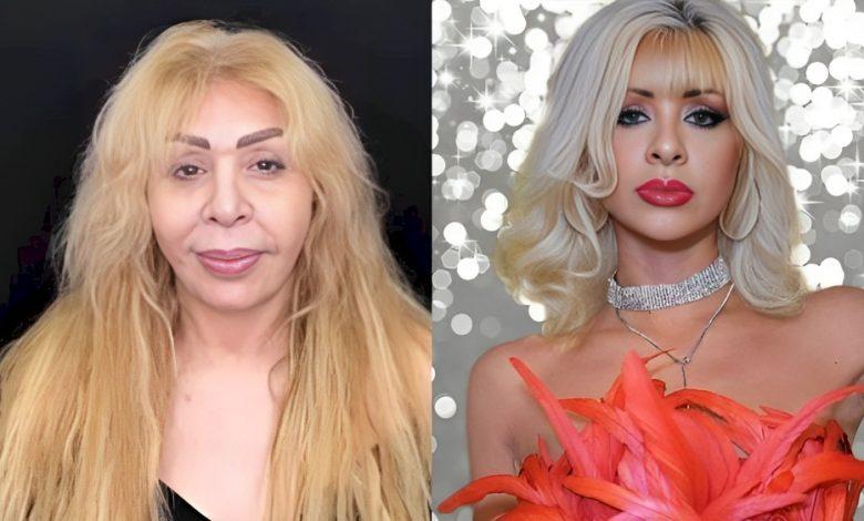 Ruhəngiz tanınmaz halda - FOTO