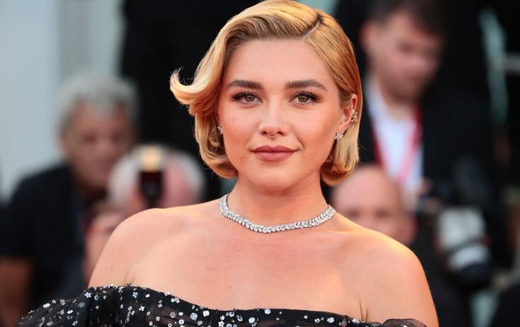 Aktrisa xəstəliyini açıqlayıb