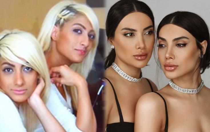 Əkizlərin əvvəlki görüntüsü - VİDEO