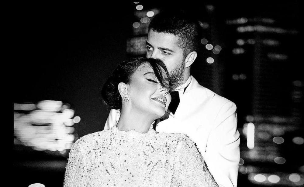 Ebru Gündeş dəyişdi - FOTO