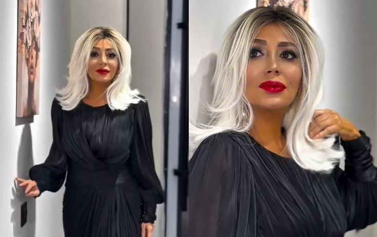 Emma plastik əməliyyat etdirməyib